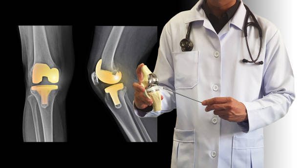 Surgeon For Partial Knee Replacement in Girgaon